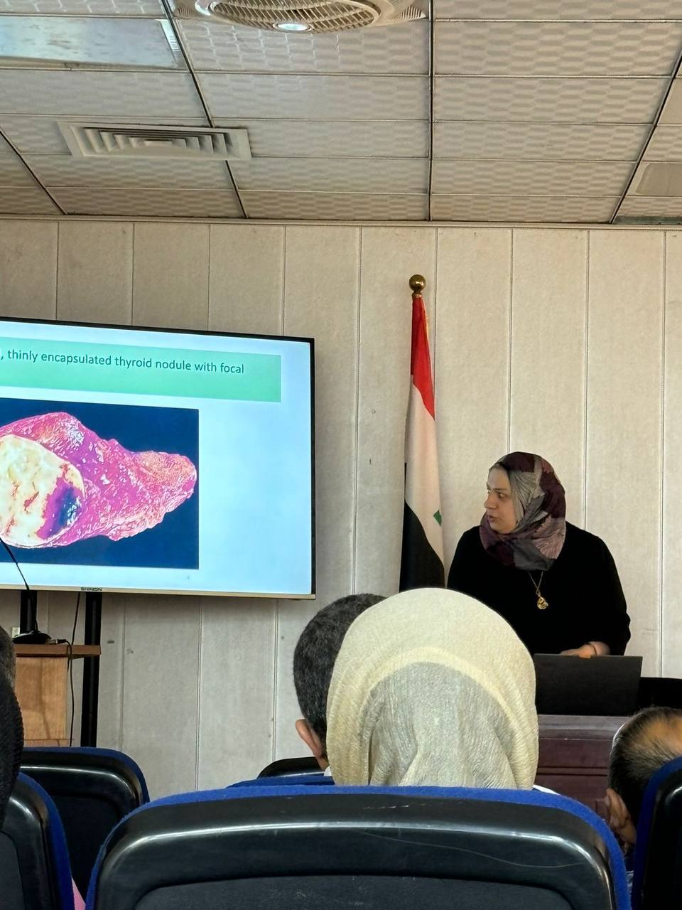 Thyroid tumors lecture