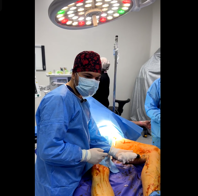 Left leg varicose vein removal surgery