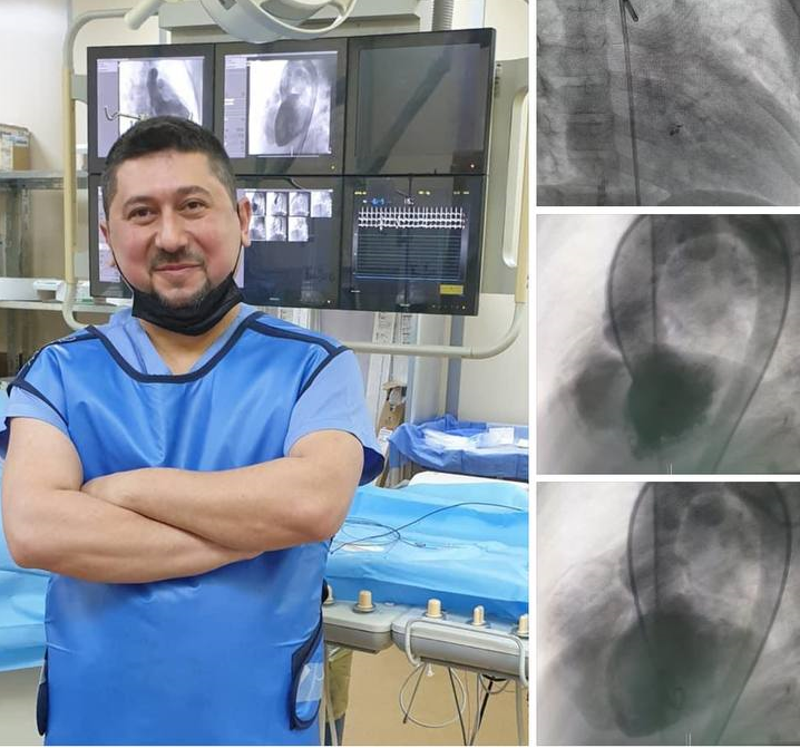 Large ventricular septal defect closure surgery