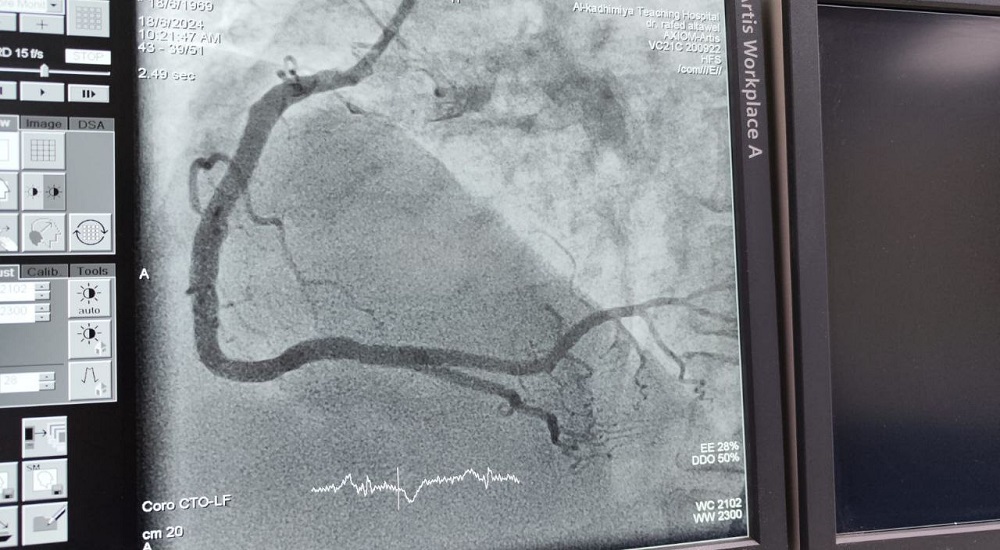 Assistant Professor Dr. Rafid Basheer Al-Tawil provided a catheterization medical service to a patient on the second day of Eid al-Adha.