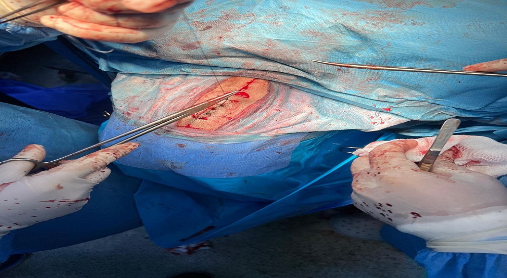 Brain tumor removal surgery for a 12-year-old child.